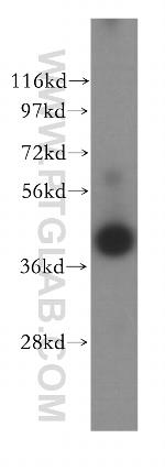 IL2RG Antibody in Western Blot (WB)