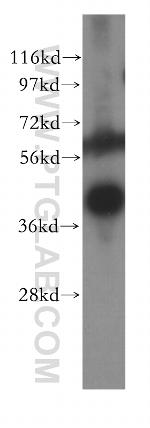 IL2RG Antibody in Western Blot (WB)