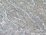 NAT2 Antibody in Immunohistochemistry (Paraffin) (IHC (P))