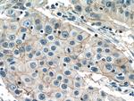 NAT2 Antibody in Immunohistochemistry (Paraffin) (IHC (P))