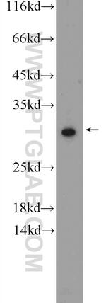 COX7C Antibody in Western Blot (WB)