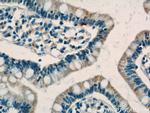 C1QTNF3 Antibody in Immunohistochemistry (Paraffin) (IHC (P))