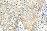 MARCKSL1 Antibody in Immunohistochemistry (Paraffin) (IHC (P))