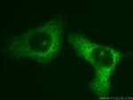 EIF3M Antibody in Immunocytochemistry (ICC/IF)