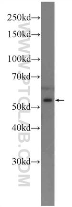 RARG Antibody in Western Blot (WB)