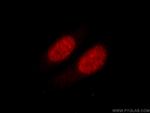 HNRNPK Antibody in Immunocytochemistry (ICC/IF)