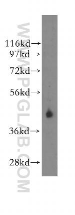 Kallistatin Antibody in Western Blot (WB)