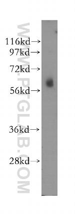 STK32C Antibody in Western Blot (WB)