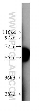 STK32C Antibody in Western Blot (WB)