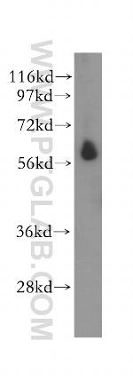STK32C Antibody in Western Blot (WB)
