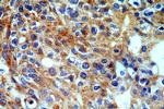 CRBN Antibody in Immunohistochemistry (Paraffin) (IHC (P))