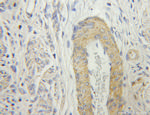 CRBN Antibody in Immunohistochemistry (Paraffin) (IHC (P))