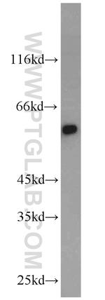 CRBN Antibody in Western Blot (WB)