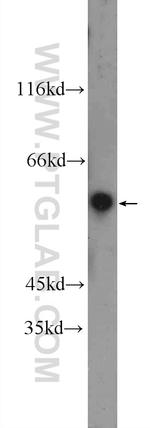 PRAME Antibody in Western Blot (WB)