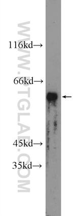 PRAME Antibody in Western Blot (WB)