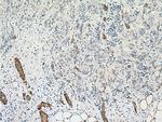 EHD2 Antibody in Immunohistochemistry (Paraffin) (IHC (P))