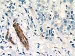EHD2 Antibody in Immunohistochemistry (Paraffin) (IHC (P))
