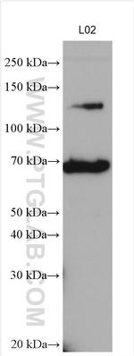 PNPLA3 Antibody in Western Blot (WB)