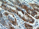 CA9 Antibody in Immunohistochemistry (Paraffin) (IHC (P))