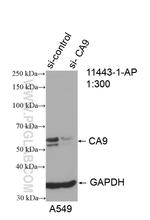 CA9 Antibody in Western Blot (WB)