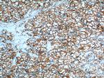 CA9 Antibody in Immunohistochemistry (Paraffin) (IHC (P))