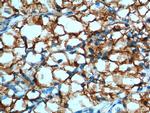CA9 Antibody in Immunohistochemistry (Paraffin) (IHC (P))