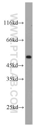 CA9 Antibody in Western Blot (WB)