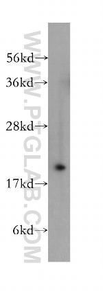 RAB24 Antibody in Western Blot (WB)