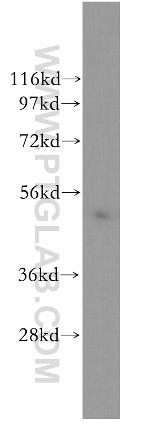Human IgA Heavy Chain Antibody in Western Blot (WB)