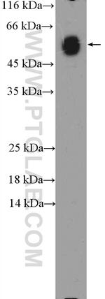 Human IgA Heavy Chain Antibody in Western Blot (WB)
