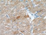 Myozenin 2 Antibody in Immunohistochemistry (Paraffin) (IHC (P))