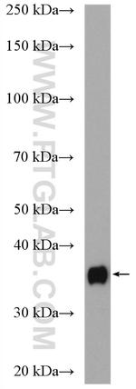 Myozenin 2 Antibody in Western Blot (WB)