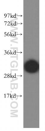 Myozenin 2 Antibody in Western Blot (WB)