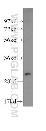 NQO1 Antibody in Western Blot (WB)