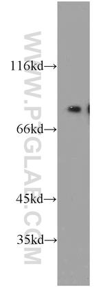 MIER1 Antibody in Western Blot (WB)