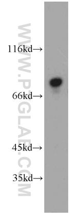 MIER1 Antibody in Western Blot (WB)