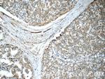 COPE Antibody in Immunohistochemistry (Paraffin) (IHC (P))
