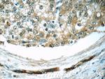 COPE Antibody in Immunohistochemistry (Paraffin) (IHC (P))