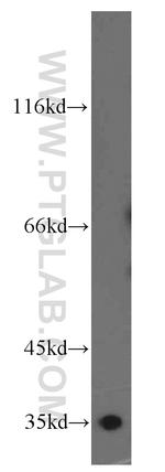 COPE Antibody in Western Blot (WB)