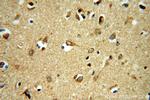 PRUNE2 Antibody in Immunohistochemistry (Paraffin) (IHC (P))