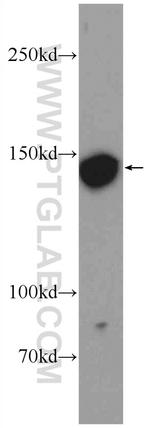 PRUNE2 Antibody in Western Blot (WB)