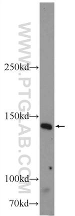 PRUNE2 Antibody in Western Blot (WB)