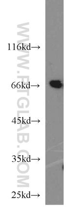 STXBP1 Antibody in Western Blot (WB)