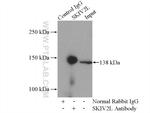 SKIV2L Antibody in Immunoprecipitation (IP)