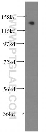 SKIV2L Antibody in Western Blot (WB)