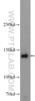 SKIV2L Antibody in Western Blot (WB)