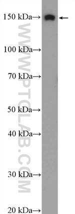 SKIV2L Antibody in Western Blot (WB)