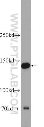 SKIV2L Antibody in Western Blot (WB)