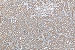 Calpain 2 Antibody in Immunohistochemistry (Paraffin) (IHC (P))
