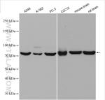 Calpain 2 Antibody in Western Blot (WB)